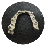 Full-arch dental implant